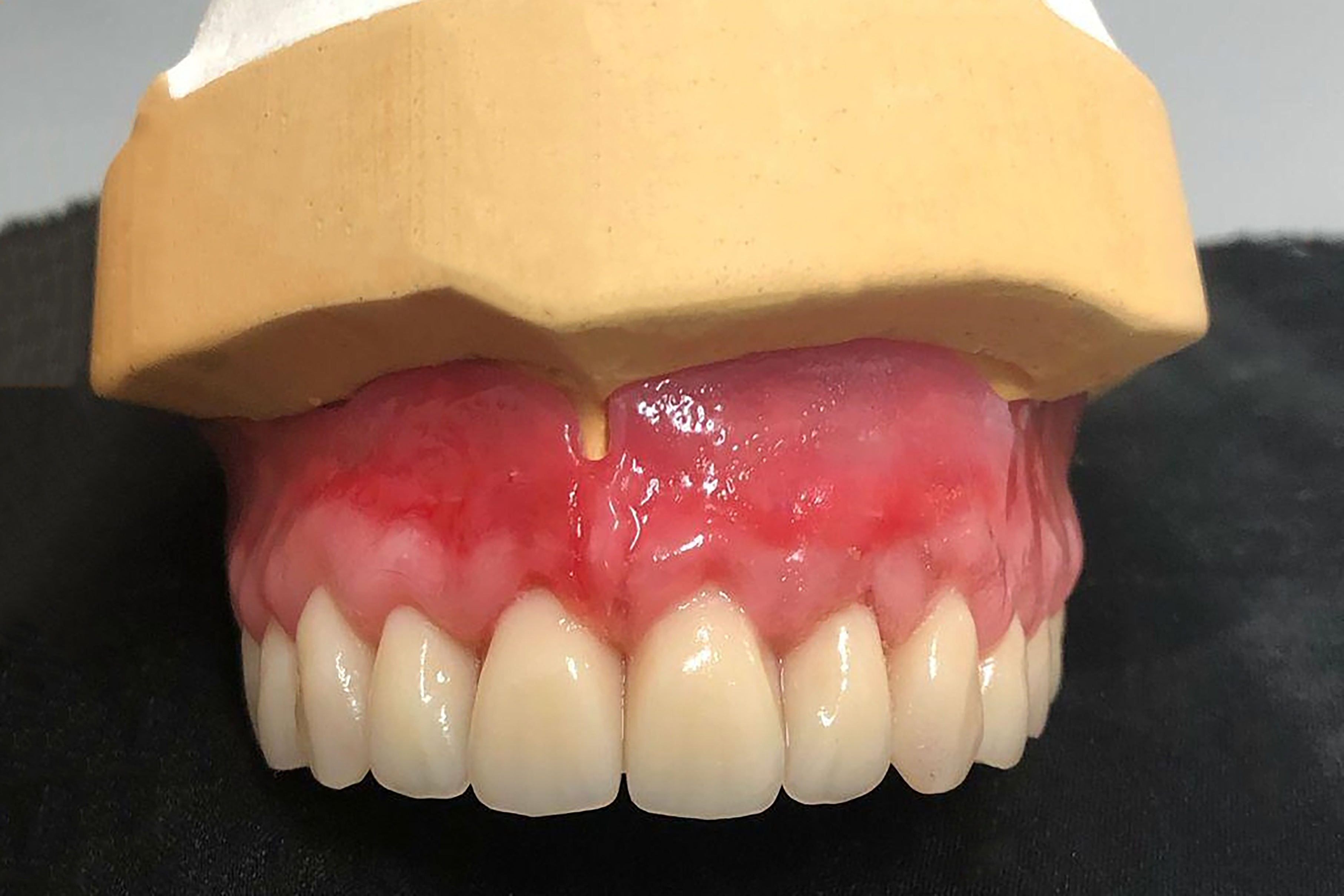 Modellazione Protesi Dentale Superiore - Odontotecnico
