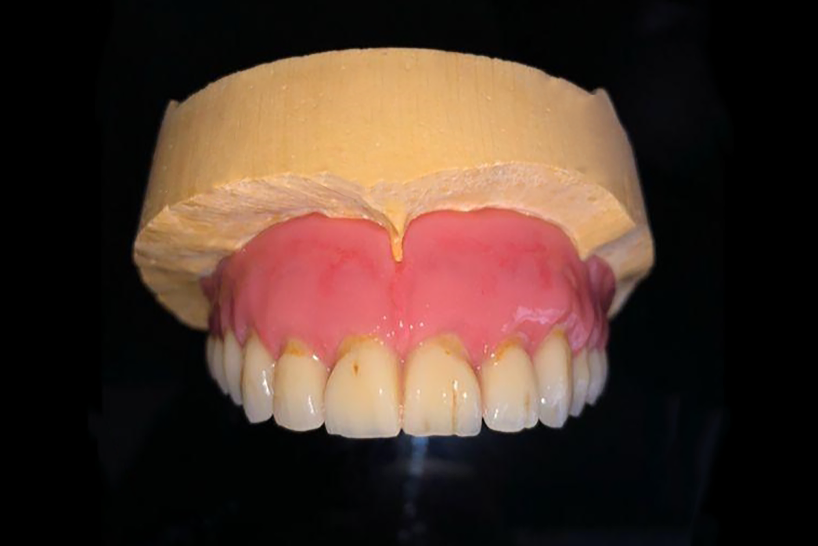 Protesi Dentale Mobile Superiore - Odontotecnico